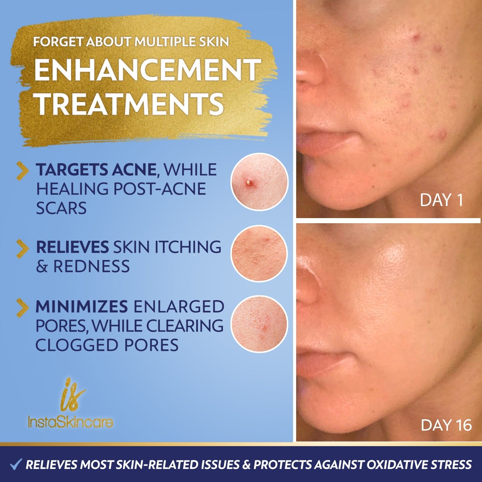 Niacinamide Serum for Face 10% with Zinc 1% Vitamin B3 Serum - 2oz